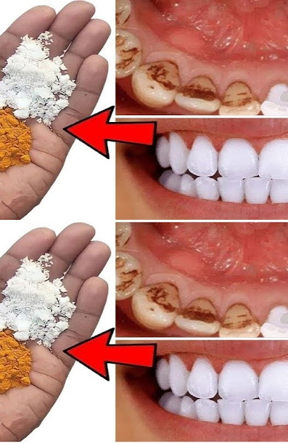 A Simple and Efficient Way to Whiten Your Teeth You Can Do at Home to Brighten Your Smile