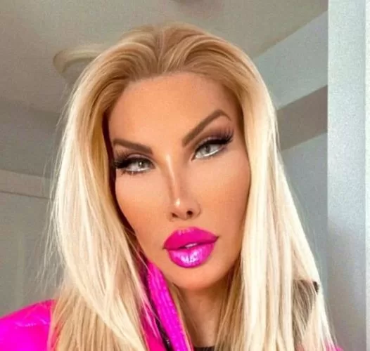 Transgender woman spent millions to achieve Barbie-like appearance: What does her “human Ken doll” boyfriend look like?