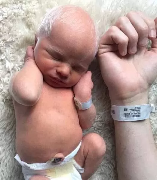 Baby Mocked For Having White Hair – But Wait Till You See How He Looks Years Later