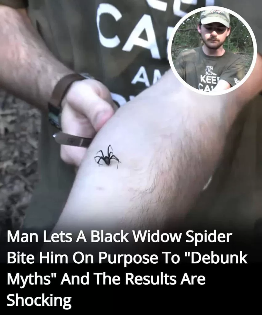 To Debunk Myths About Arachnids, A Wildlife Enthusiast Lets A Black Widow Bite Him, But Wait Till You See The Results