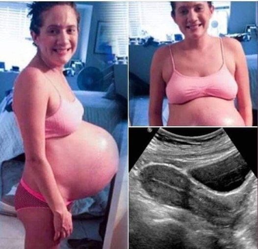 After three terrible years of infertility, she becomes pregnant, but what’s inside her belly isn’t what anyone expected.